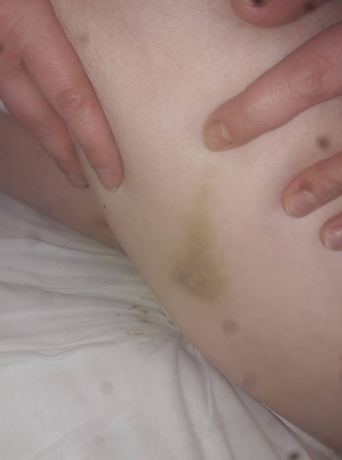 Radviliškio ligoninės pacientė teigia, kad yra mušama personalo darbuotojų.